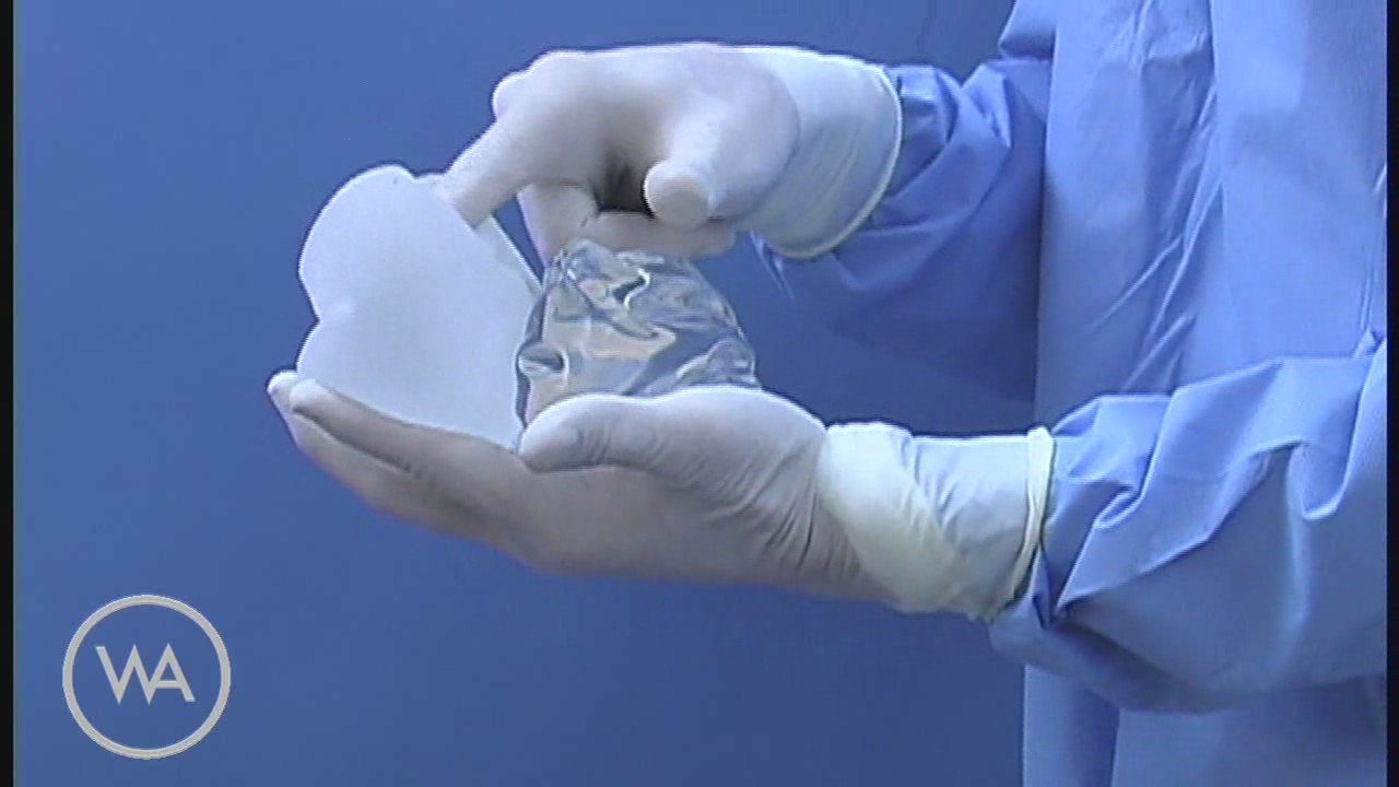 Cohesive Silicone Gel Breast Implant 69